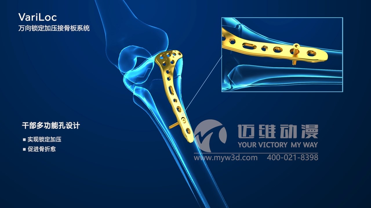 醫學(xué)醫療三維動(dòng)畫(huà) 醫學(xué)醫療三維動(dòng)畫(huà)
