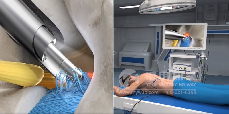 三維動(dòng)畫(huà)給醫學(xué)領(lǐng)域帶來(lái)哪些便利？(圖4)