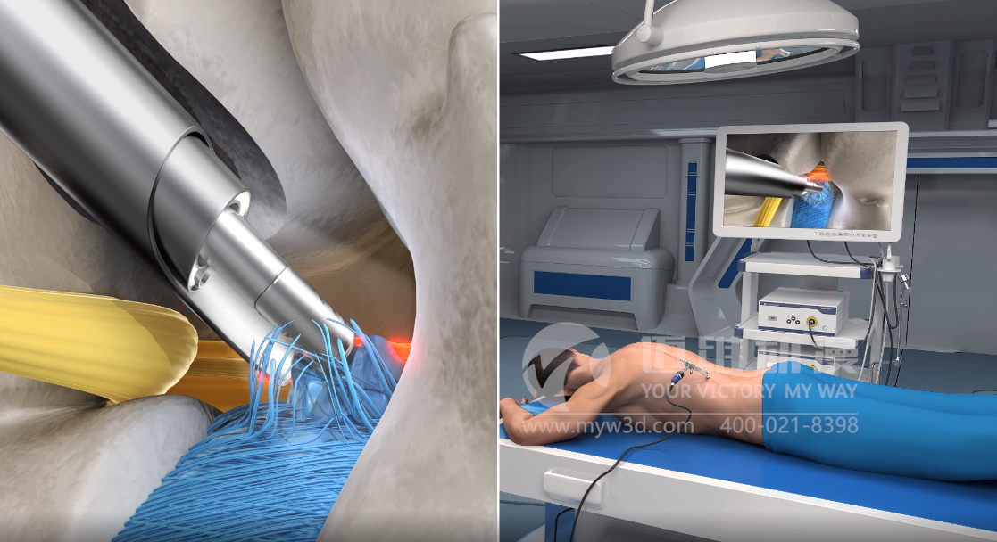 三維動(dòng)畫(huà)設計助力醫學(xué)醫療行業(yè)健康發(fā)展！(圖4)