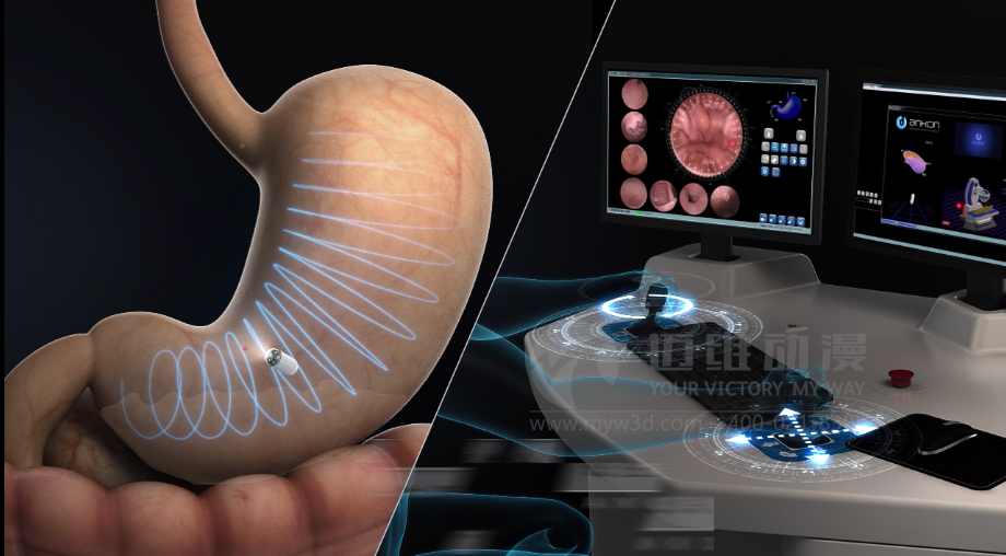 醫用設備三維動(dòng)畫(huà)制作好處有哪些？(圖3)