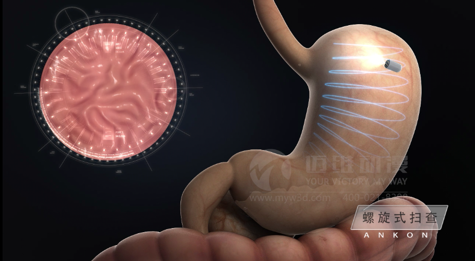 醫用設備三維動(dòng)畫(huà)制作好處有哪些？(圖2)