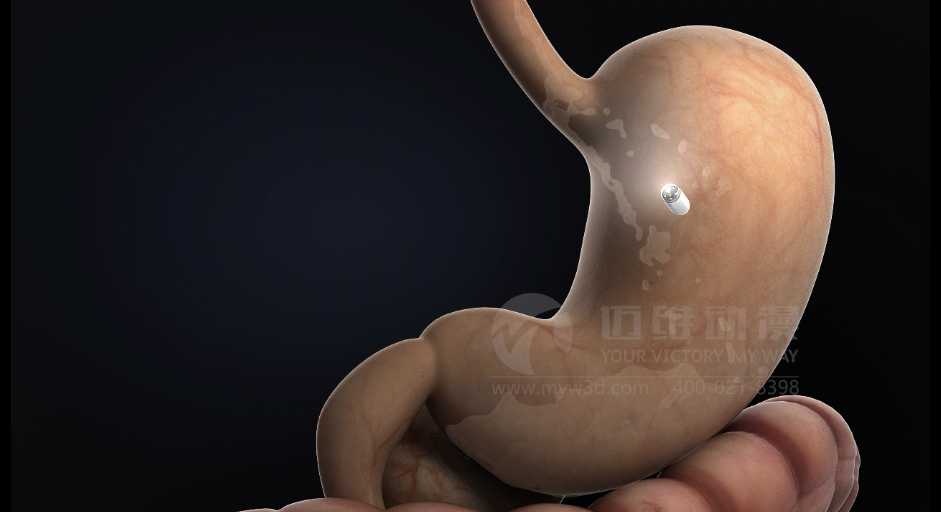 醫用設備三維動(dòng)畫(huà)制作好處有哪些？(圖1)